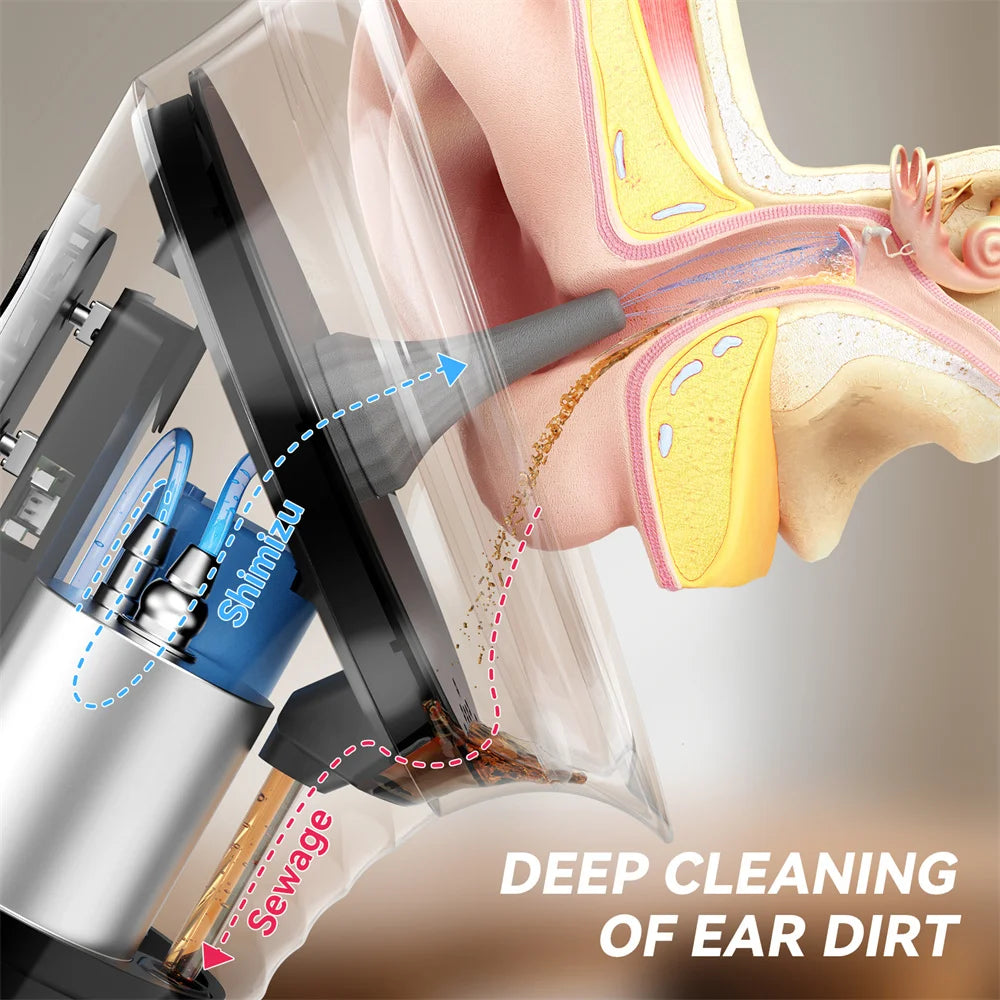 SUNUO Electric Water Powered Ear Wax Removal Irrigation Cleaning System