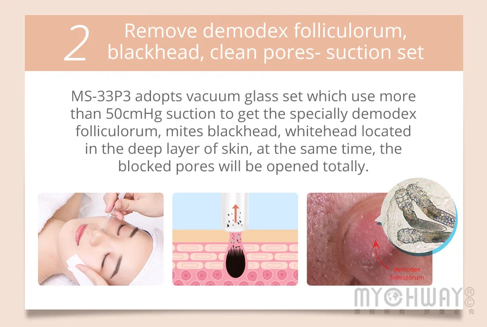 Mychway 3 In 1 Facial Cleansing Ultrasound Beauty Device